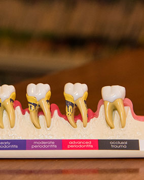 occlusal disease